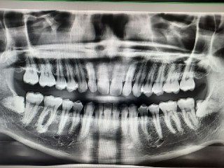 [photo](media:AgACAgUAAx0CT0ncdwABAdy1X1iytilb5HJ4UNJo2vGhzrvVWDMAAu6qMRvBqMlWH4MnwtE0zYUfJ8RsdAADAQADAgADbQADHkkAAhsE@telegram)