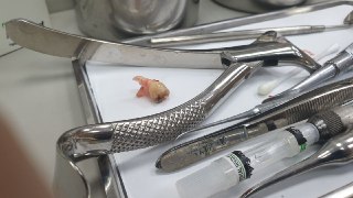 [photo](media:AgADBQAD-agxGxOM8VYT9f1nv0PfrpizJTMABAEAAwIAA20AA-FIAAIWBA@telegram)